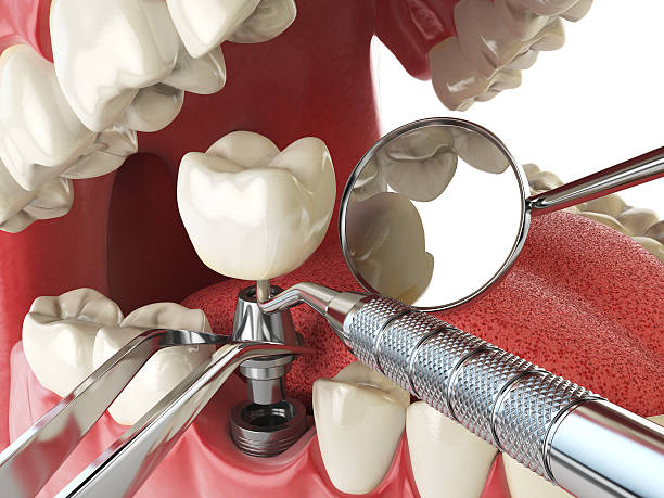 Best Cracked Tooth Emergency Dentist  in Hermosa Beach, CA